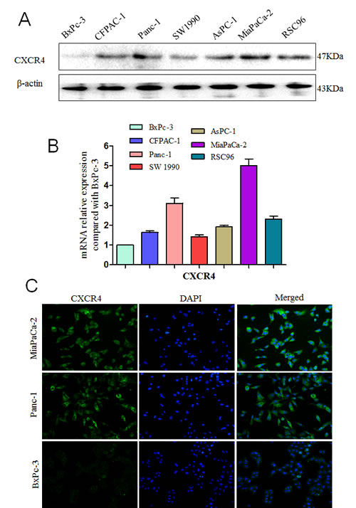 Fig.1: Expression levels of CXCR4 and CXCL12 in pancreatic cancers.