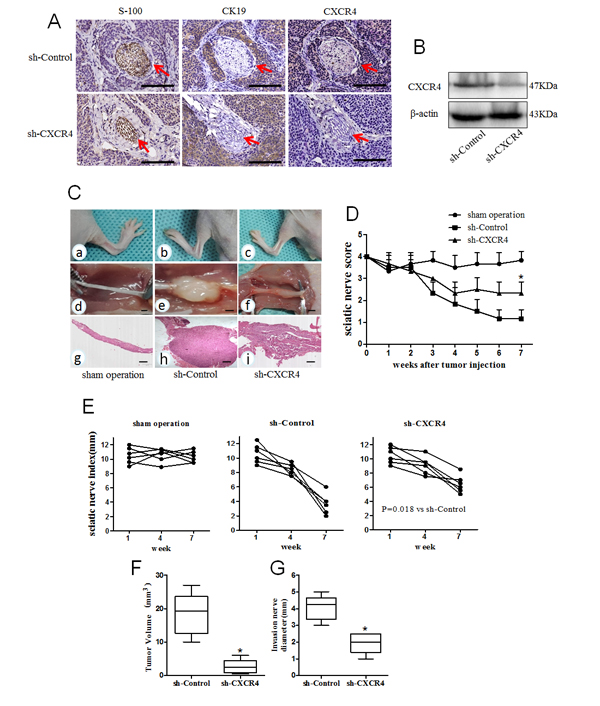 Fig.6: Relationship between CXCL12/CXCR4 axis and PNI of pancreatic cancer