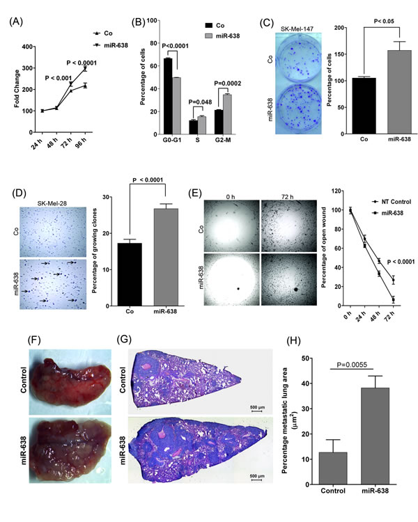 miR-638 promotes tumorigenic and metastatic properties of melanoma cells