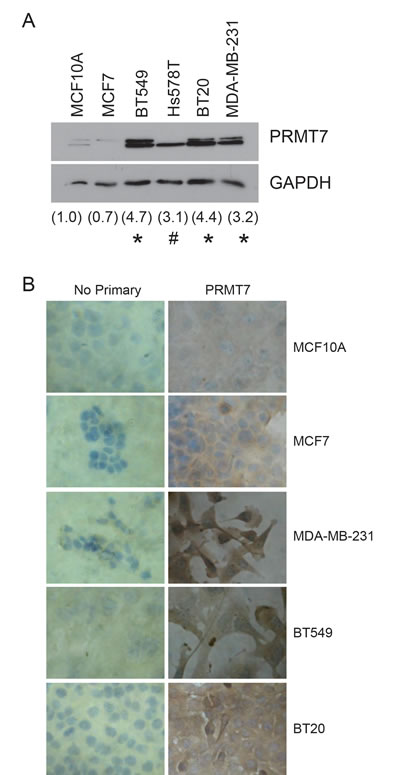 PRMT7 is overexpressed in breast cancer cell lines.