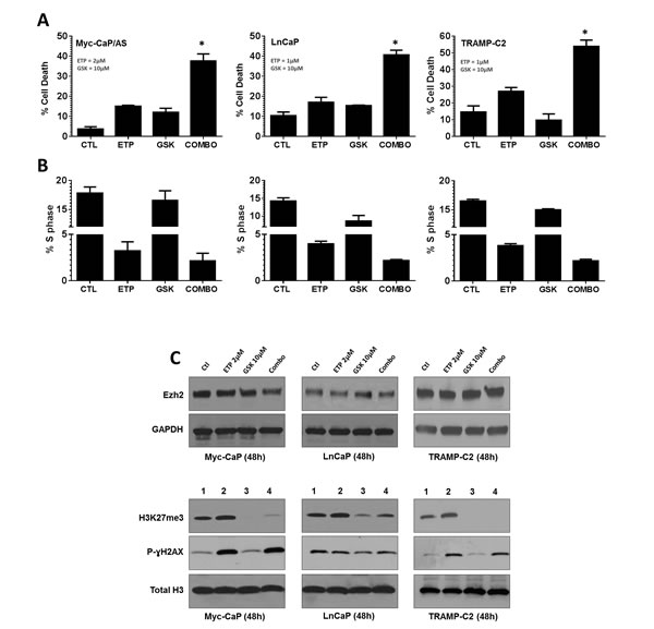 Inhibition of Top2 and Ezh2 in combination increases anti-tumor response in murine and human models of prostate cancer.