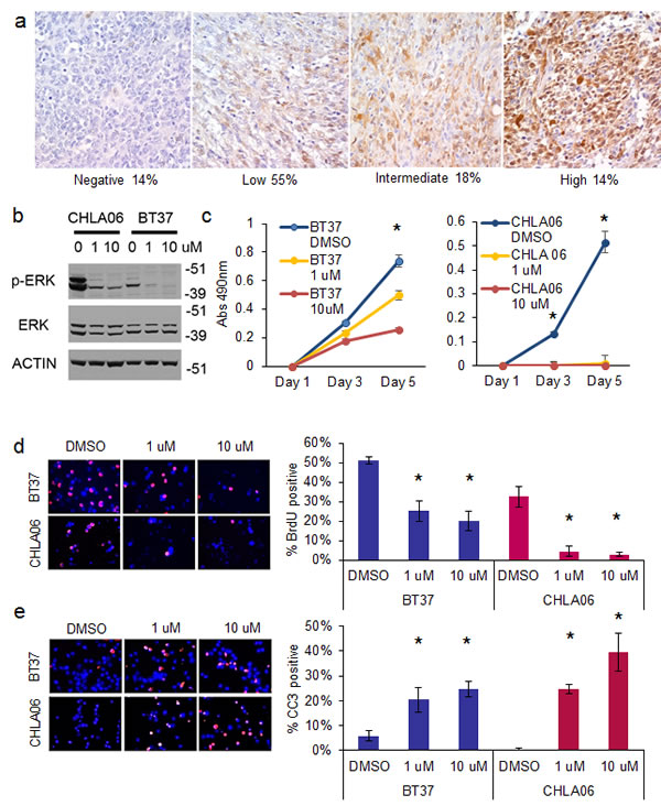 Fig.5: Inhibition of the MAP kinase pathway with MEK inhibitor selumetinib suppresses the growth and proliferation of AT/RT cells and induces apoptosis.