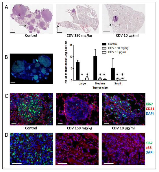 Immunohistochemical analysis of F2T-luc2.9 cell-induced lung metastases.