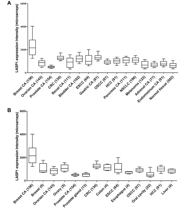 Gene expression patterns of LASP1 in human carcinoma tissues: