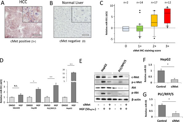 miR-93 expression correlates with HGF and c-Met IHC intensity.