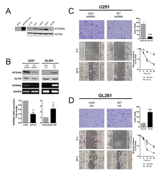 Effect of KITENIN overexpression and knockdown on the invasion and migration of human and mouse glioma cell lines.