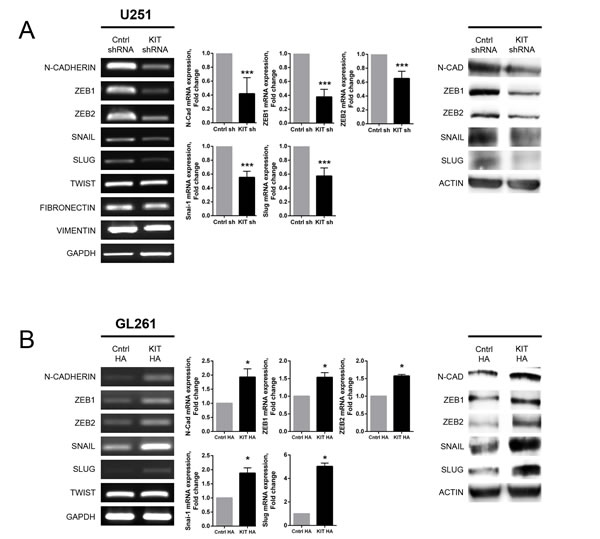 Altered expression of EMT markers associated with KITENIN modulation in U251 and GL261 cells.