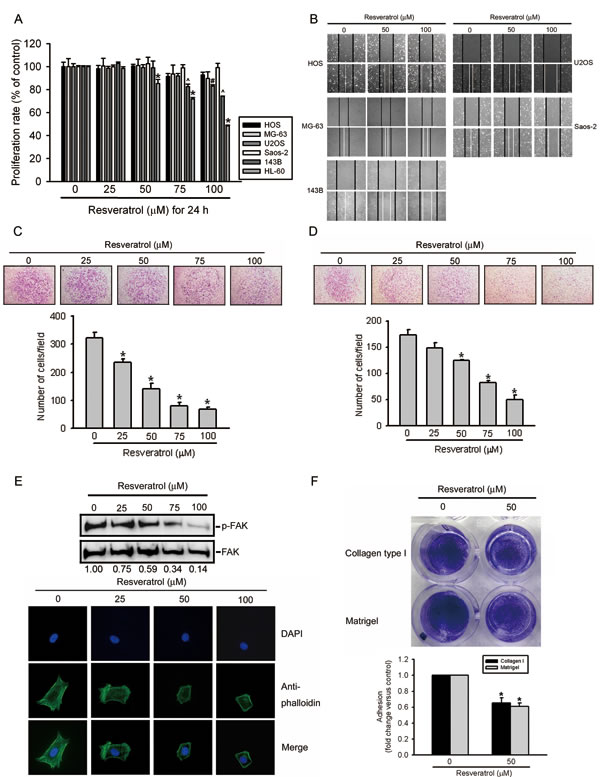 Resveratrol inhibits cell migration, invasion, and adhesion abilities of human osteosarcoma cells.