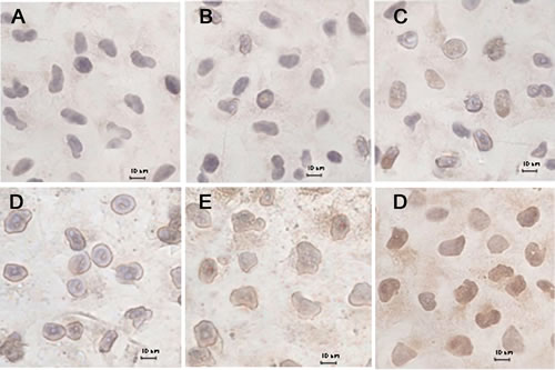 Fig.6: Immunohistochemical staining of cytochrome C translocated from mitochondria to the cytosol in MCF-7/Adr cells after incubation with different formulations, including a blank control.
