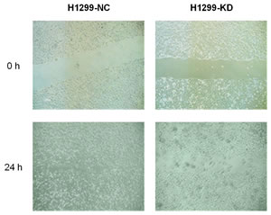 Migration capacity of H1299-KD and H1299-NC cells H1299-NC cells covered with scratches after 24 hours of incubation, whereas the same phenomena were not observed on H1299-KD cells.