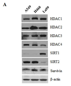 Correlation between HDAC2 and survivin expression in lung cancer cell lines and overexpression of HDAC2 and survivin in lung cancer patients.
