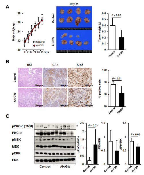 Effect of EP2/EP4 antagonism on IGF-1-expressing pancreatic tumor growth