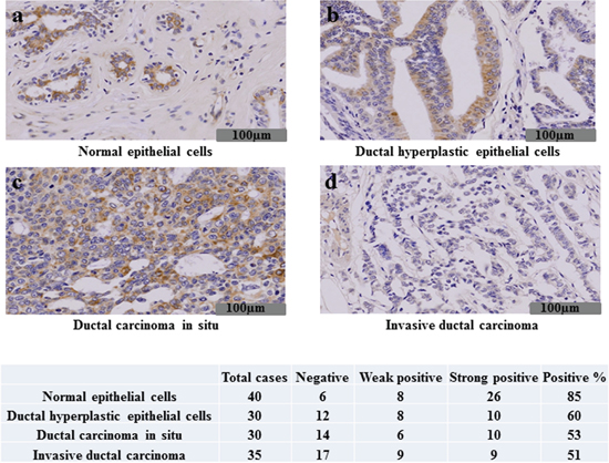 Immunohistochemical expression of TRIP-Br3 in breast tissues.