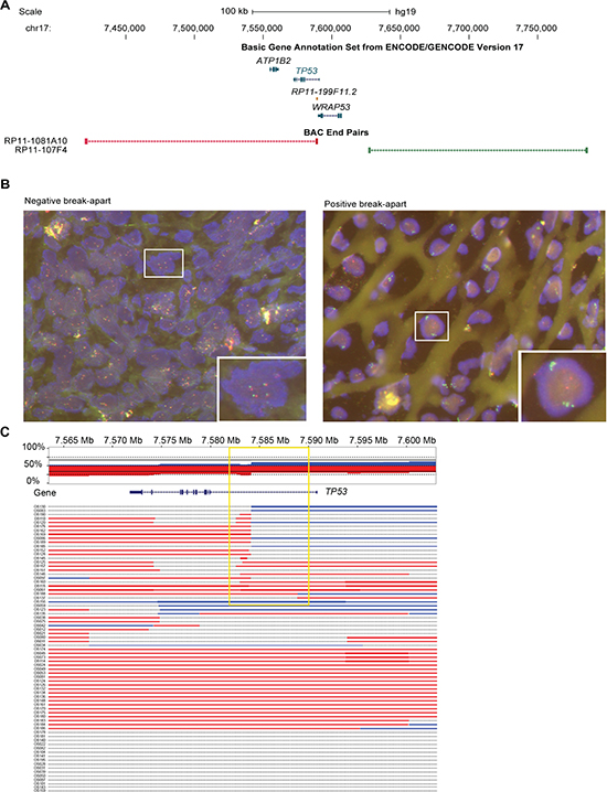 Translocation hotspot in intron 1 of TP53 in OS samples.