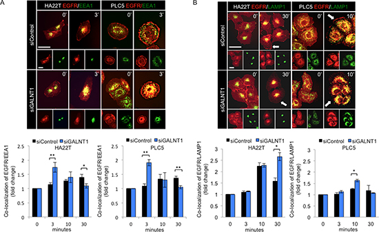 Knockdown of GALNT1 enhances EGFR co-localization with EEA1 and LAMP1.