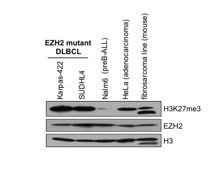 Levels of histone H3K27me3 in EZH2