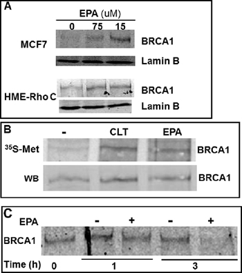 EPA translationally up-regulates BRCA1 in human breast cancer cells.