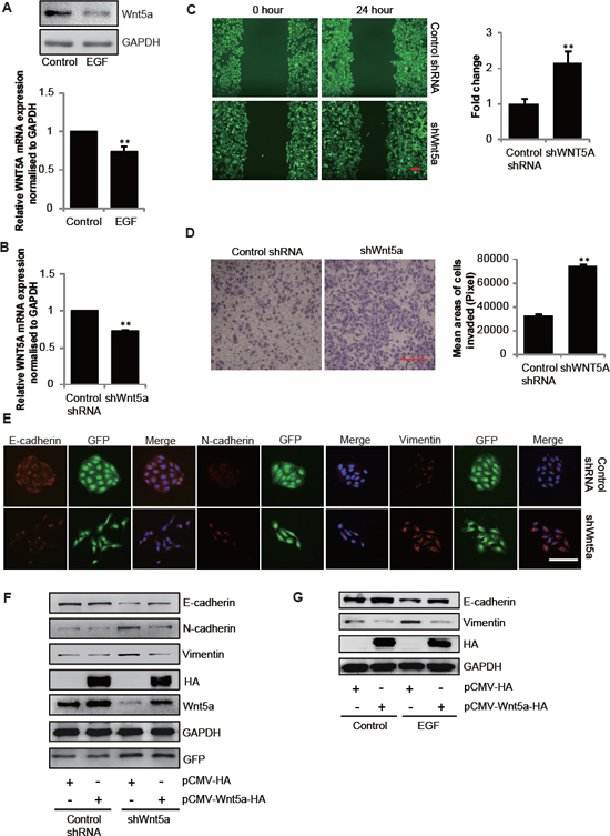 Downregulation of Wnt5a in SGC-7901 cells is necessary for EGF-induced EMT.