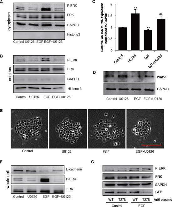 EGF/Arf6 reduces Wnt5a expression and promotes cell EMT through P-ERK.