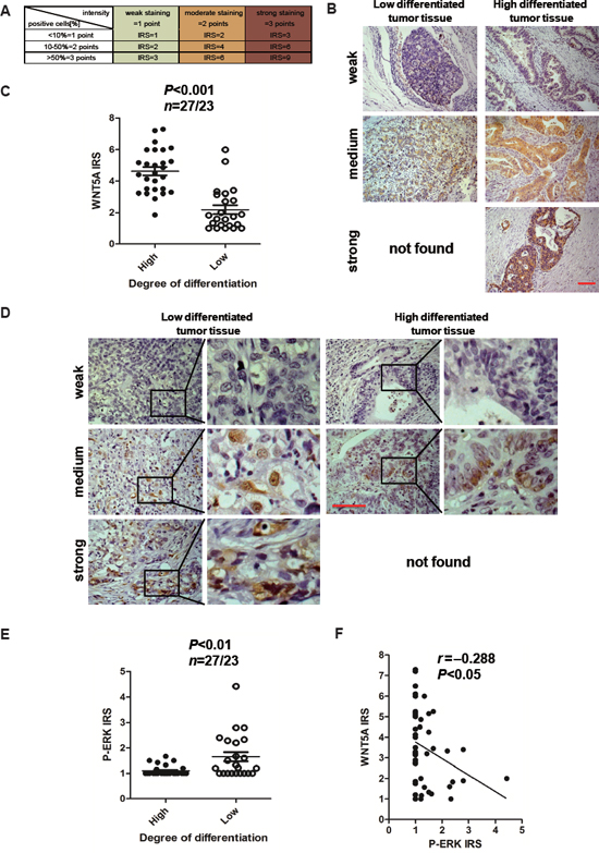 Wnt5a expression is relative with the high degree differentiation of malignant gastric cancer and has a negative correlation with P-ERK.