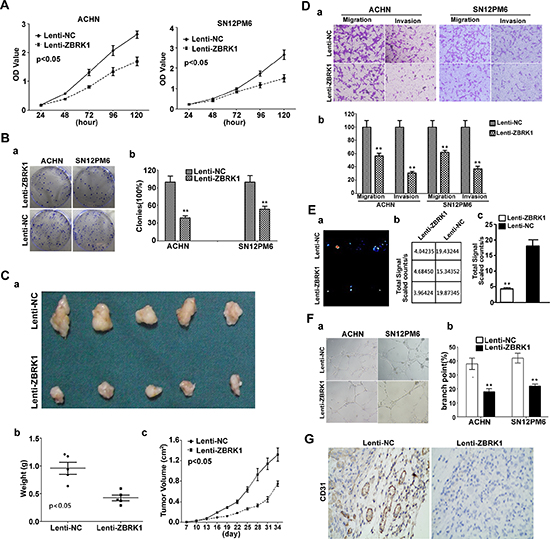 ZBRK1 inhibits cell growth, tube formation, migration and invasion in renal cancer.