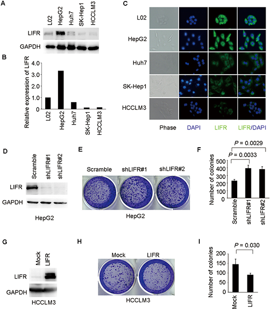 LIFR inhibits ability of colony formation of HCC cells.