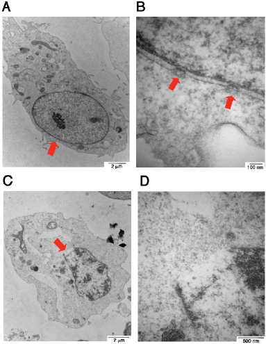 Electron microscopy of UV/cold shock-induced gas formation to cause damage to the nucleus.