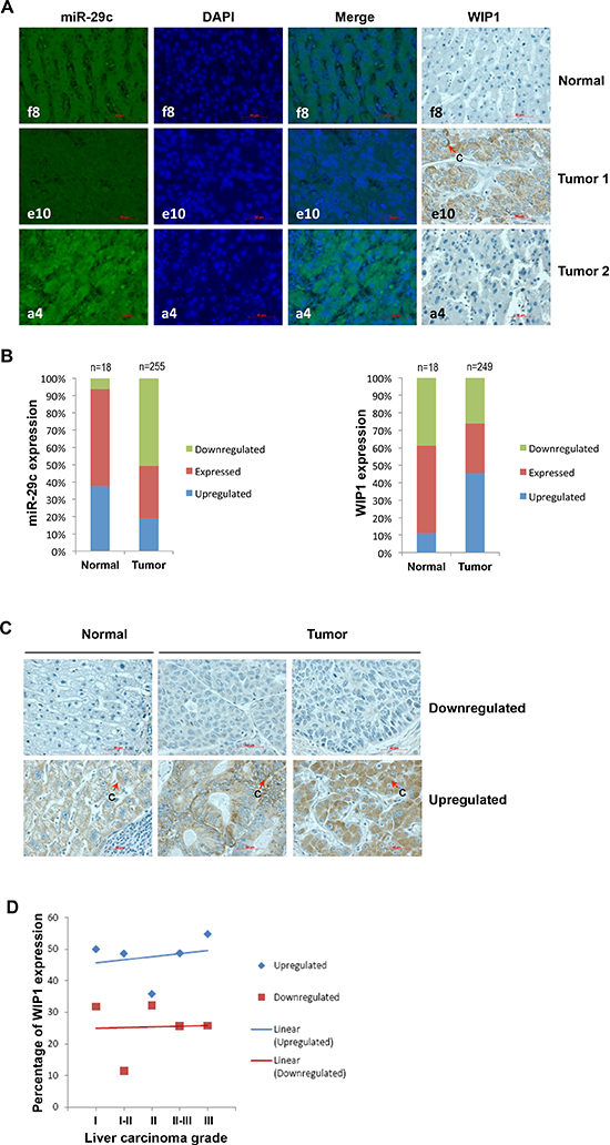The expression of miR-29c and WIP1 in hepatocellular carcinoma tissues.