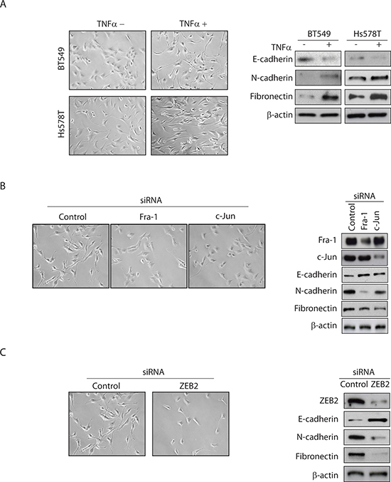 TNF&#x03B1;-mediated EMT in TNBC cells is dependent on AP-1&#x2013;ZEB2 signaling.