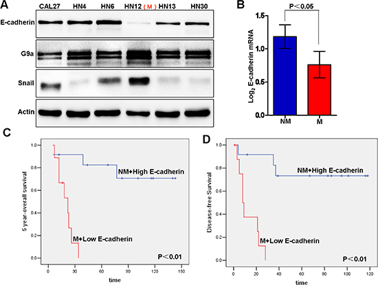 E-cadherin repression is associated with metastasis and poor clinical outcome in head and neck squamous cell carcinoma (HNSCC).