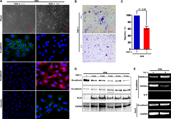 H3K9 methylation at the E-cadherin promoter is associated with TGF-&#x03B2;&#x2013;induced EMT in HNSCC.