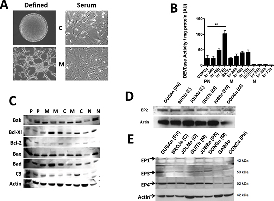 Characteristics of primary cultures derived from GBM patients.