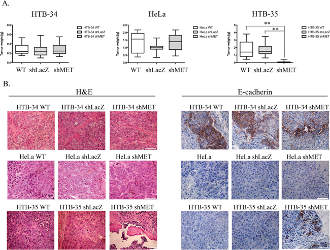Tumor growth in vivo and histopathological analysis of control and shMET cervical carcinoma cells.