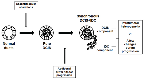 Schematic representation of suggested genomic status of pure DCIS, synchronous DCIS and IDC.