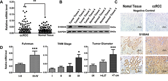 The elevated expression of S100A6 was detected in mRNA, protein and tissue of ccRCC samples.
