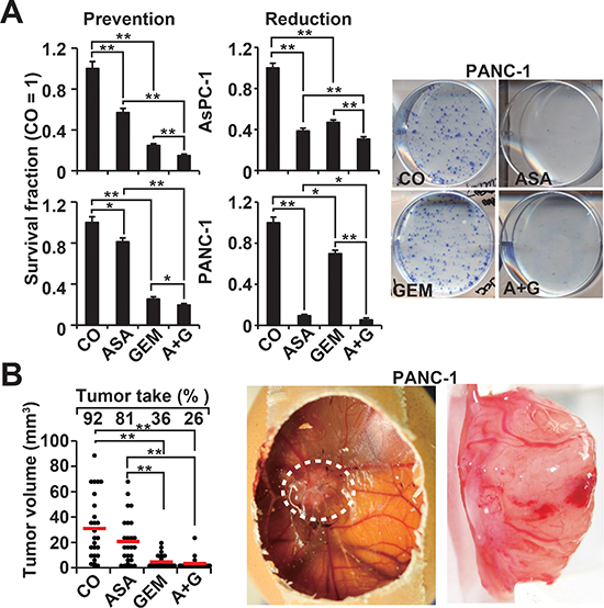 Aspirin inhibits the potential for self-renewal and enhances gemcitabine efficacy.