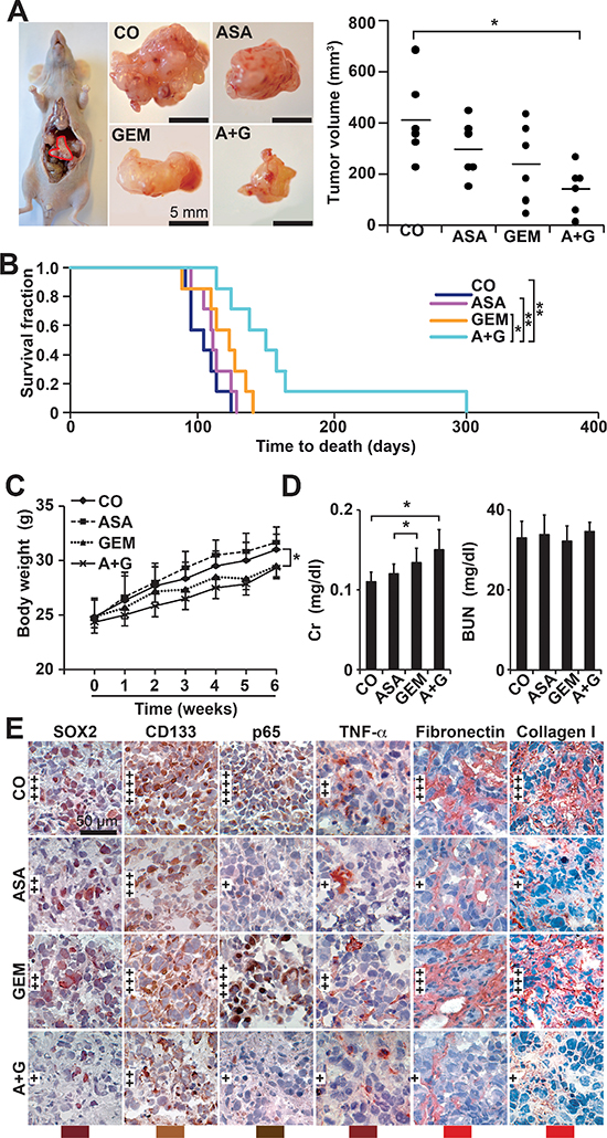 Aspirin inhibits tumor growth and progression of orthotopic mouse xenografts and enhances gemcitabine efficacy.