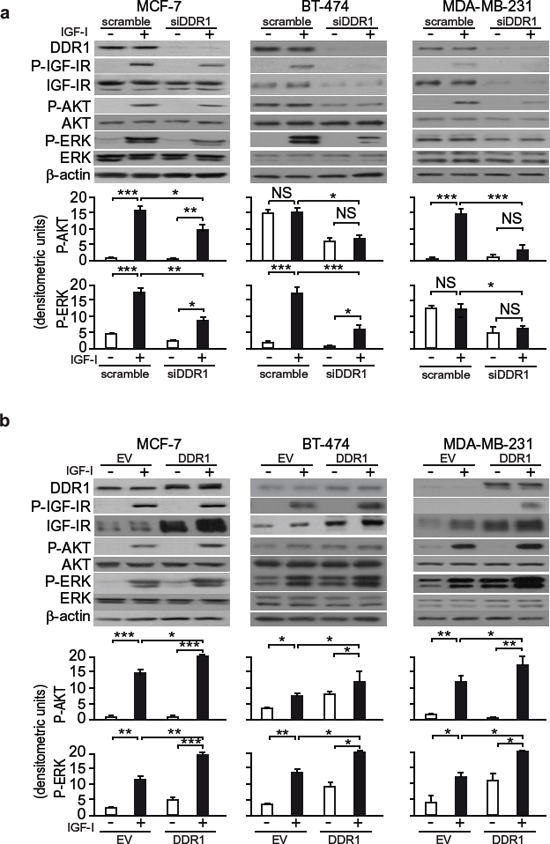 DDR1 expression level affects IGF-I downstream signaling in human breast cancer cells.