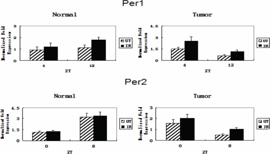 Changes in Per1 and Per2 mRNA expression in glioma and normal tissues after ionizing irradiation.