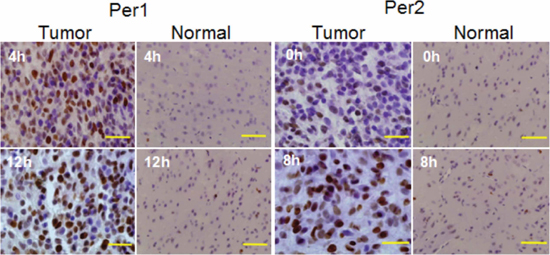 PCNA-based detection of proliferation in glioma and normal tissue subjected to x-irradiation at times (ZTs) when Per1 and Per2 mRNA levels were high and low.