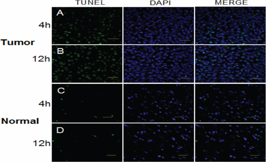 TUNEL assay to detect apoptosis in glioma and normal tissue at times of high and low expression of Per1 following a single dose of x-radiation (15 Gy).