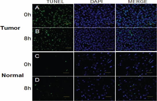 TUNEL assay to detect apoptosis in the glioma and normal tissues at times of high and low expression of Per2 after a single dose of x-radiation (15 Gy).