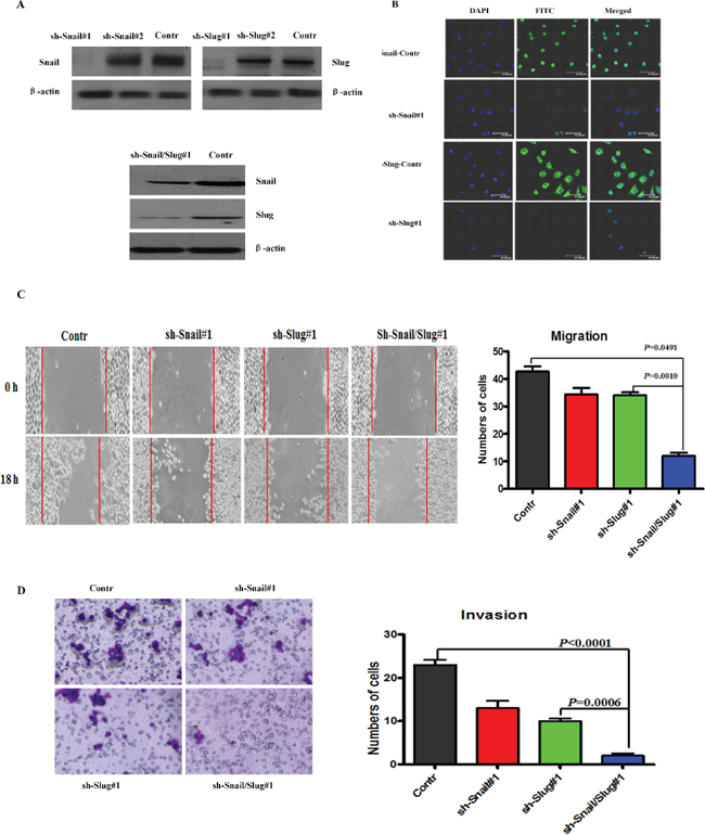 Knockdown of Snail and Slug inhibited the invasion and migration of OTSCC cells.