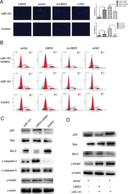 MiR-101 induces U251 cell apoptosis via LMO3.