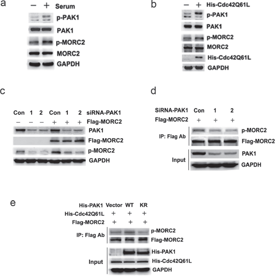 MORC2 phosphorylation at Ser-677 is dependent on PAK1.