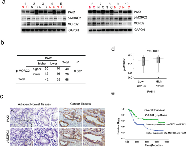 Phosphorylation of MORC2 and PAK1 expression positively correlates with clinical gastric cancer outcome.
