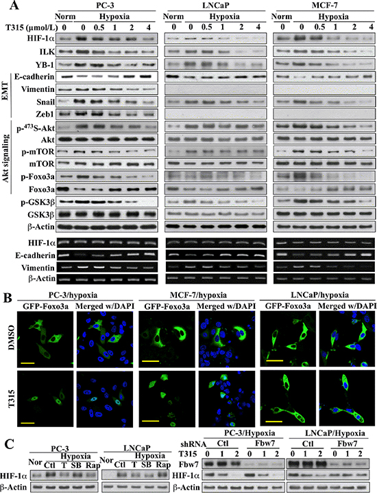 Evidence that ILK regulates HIF-1&#x03B1; expression through different mechanisms in PC-3 and MCF-7 cells versus LNCaP cells.