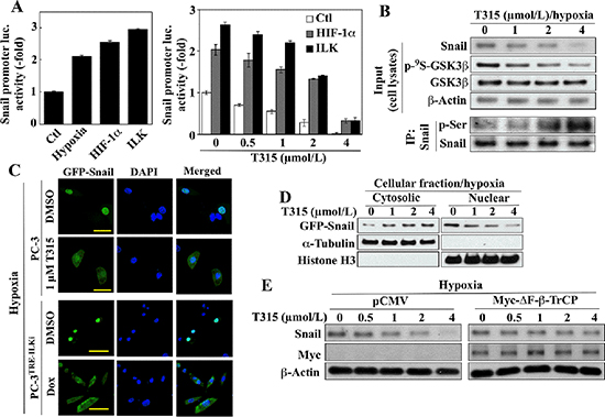 Evidence that ILK regulates Snail expression through multiple mechanisms in hypoxic conditions.