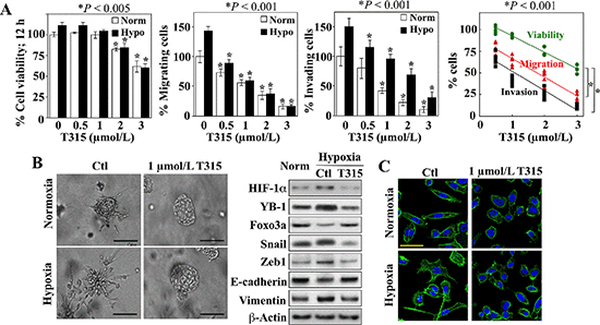 Suppressive effects of ILK inhibition on hypoxia-induced aggressive phenotype in PC-3 cells.