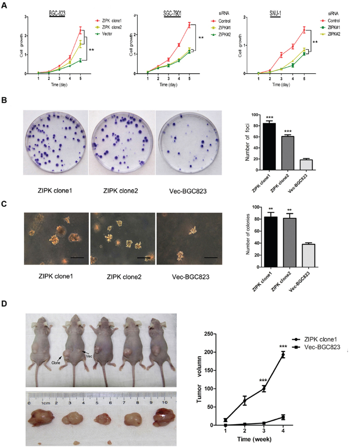 ZIPK increases tumor growth and proliferation in vitro and in vivo.